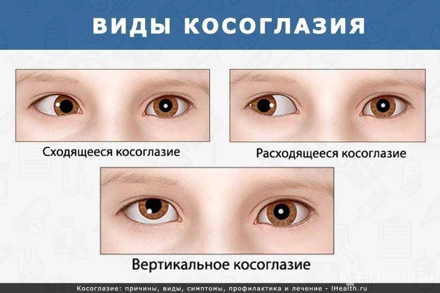 По глазам вижу. взгляд.