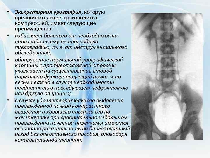 Урография – исследование почек и мочевыводящих путей