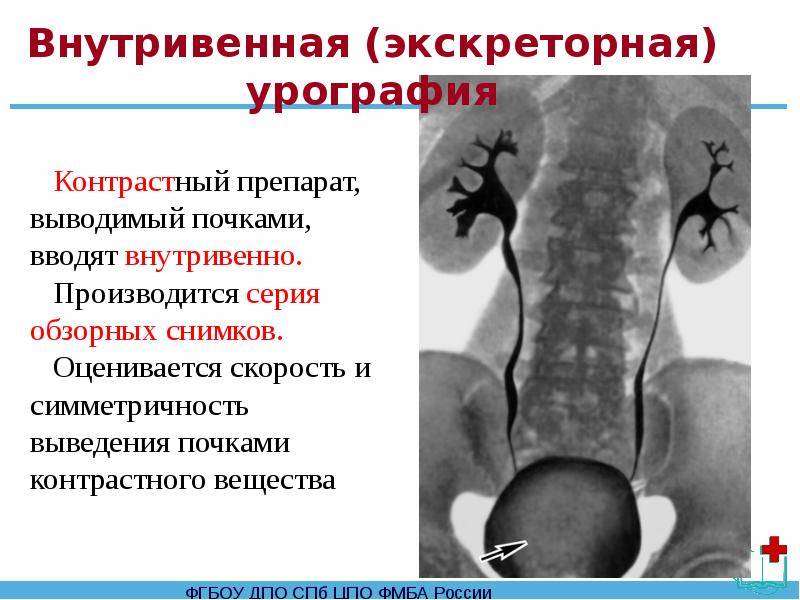 Что такое урография и как к ней подготовиться