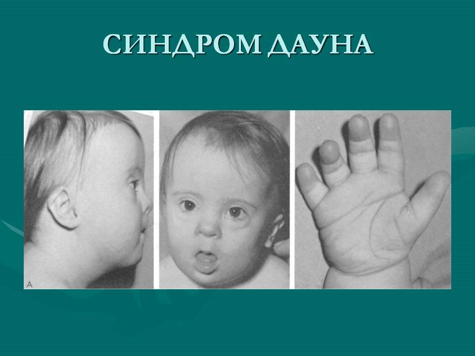 Методы статистики