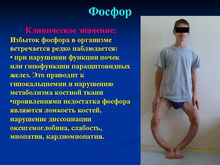 Физиогномика: почему везде хочется всунуть свой нос