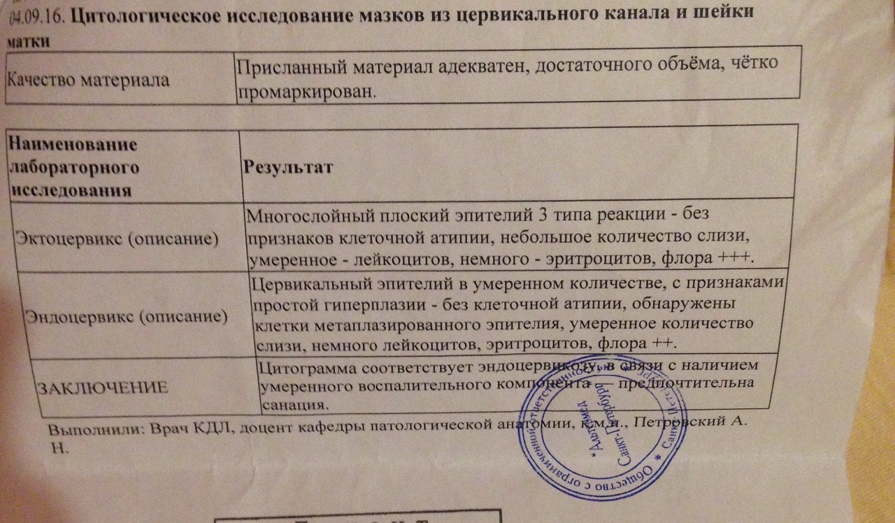 Женское здоровье: что показывает мазок на цитологию шейки матки