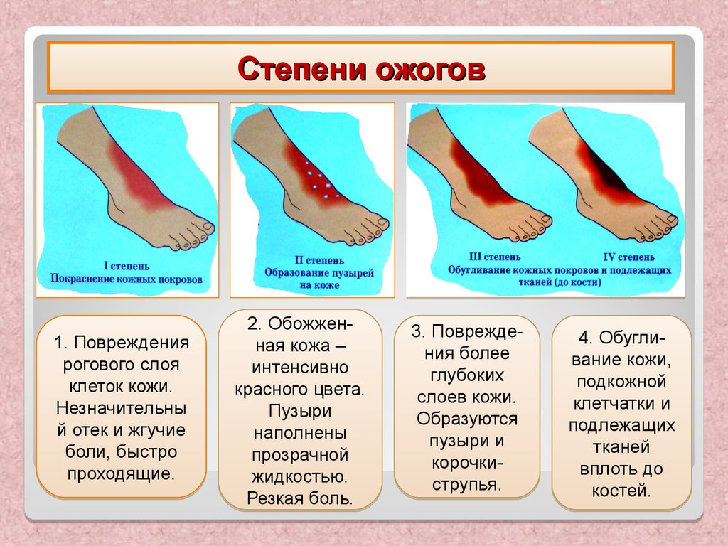 Горят руки: толкование приметы, признаки проблем со здоровьем