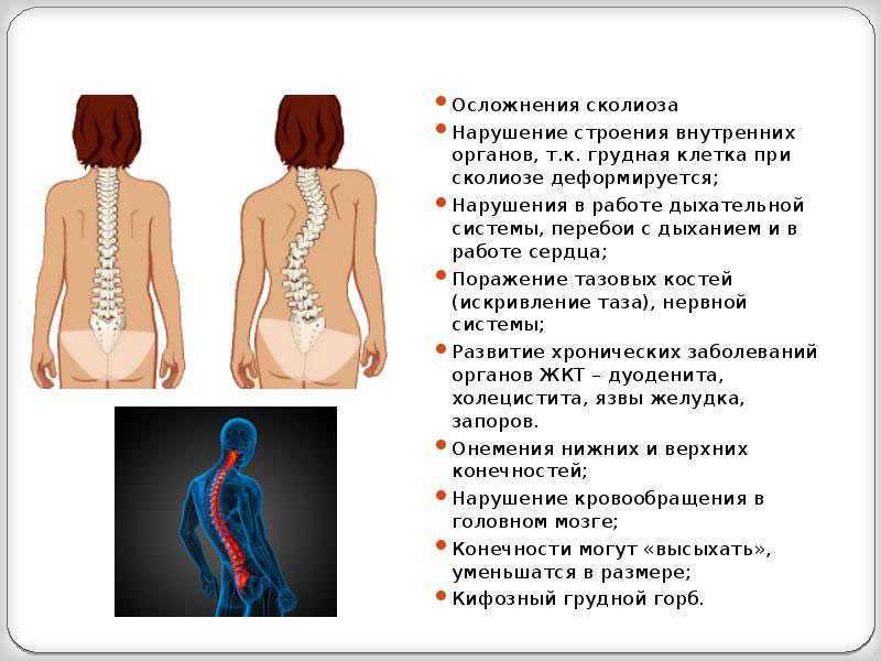 Ротация позвонков грудного, шейного отдела позвоночника: причины и лечение