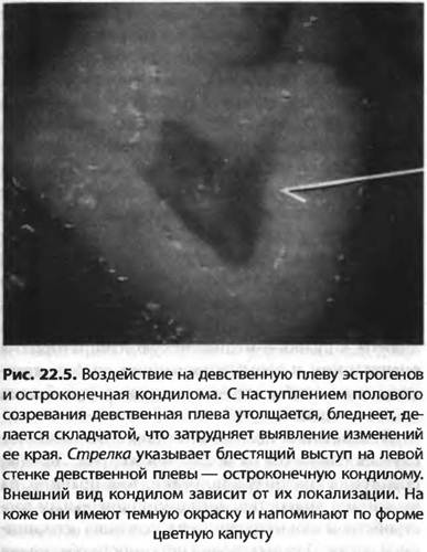 Особенности вирджинской шерсти, описание кашемировой ткани лана