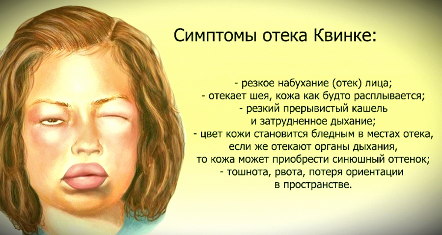Что значит быть распущенной девушкой: понятие и причины опровержения стереотипов