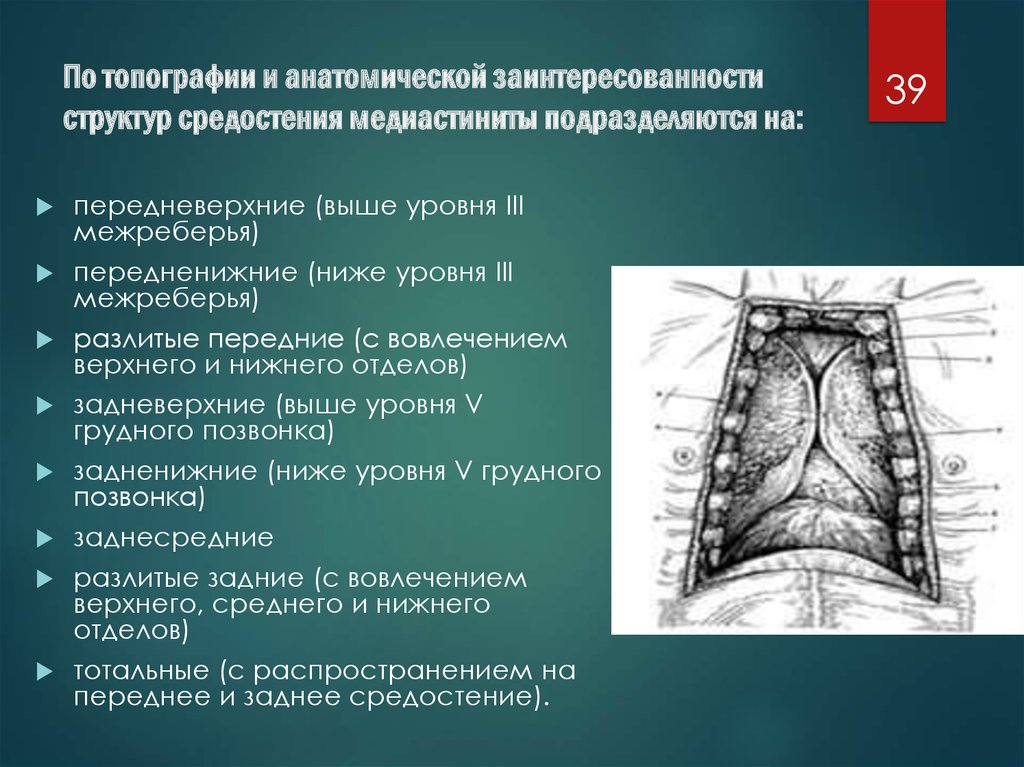 Парамедиастинально: что это значит?